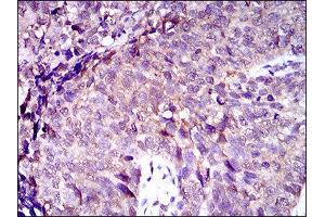 Immunohistochemistry (IHC) image for anti-ATP-Binding Cassette, Sub-Family C (CFTR/MRP), Member 4 (ABCC4) (AA 631-692) antibody (ABIN1845662)