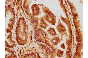 IHC image of ABIN7158282 diluted at 1:300 and staining in paraffin-embedded human prostate tissue performed on a Leica BondTM system. (CD47 antibody  (AA 44-141))