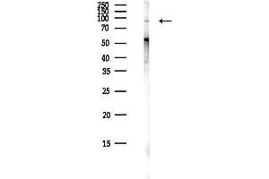 Western blot analysis of lysates from COLO205 cells(heat-shock,45 min treatment), using TRML Antibody at 1/1000 dilution.