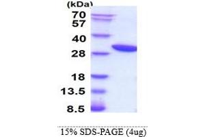 SDS-PAGE (SDS) image for Heme Oxygenase (Decycling) 1 (HMOX1) (AA 1-266) protein (His tag) (ABIN666727) (HMOX1 Protein (AA 1-266) (His tag))