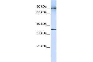 WB Suggested Anti-LRRC59 Antibody Titration:  1 ug/ml  Positive Control:  Fetal Lung cell lysate (LRRC59 antibody  (N-Term))