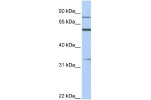 WB Suggested Anti-ZNF16 Antibody Titration:  0. (ZNF16 antibody  (C-Term))