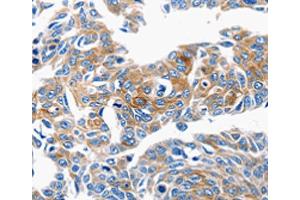 Immunohistochemistry (IHC) image for anti-Chemokine (C-C Motif) Ligand 6 (CCL6) antibody (ABIN2425645) (CCL6 antibody)