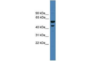 WB Suggested Anti-SERPINB2 Antibody Titration: 0.