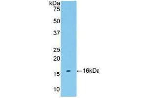 Western blot analysis of recombinant Human TMEM27. (TMEM27 antibody  (AA 17-137))