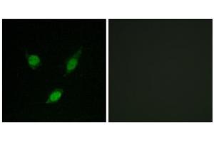 Immunofluorescence analysis of MCF-7 cells, using TACC1 antibody. (TACC1 antibody  (N-Term))