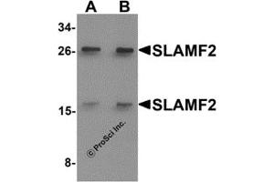 Western Blotting (WB) image for anti-CD48 (CD48) (Middle Region) antibody (ABIN1031096) (CD48 antibody  (Middle Region))