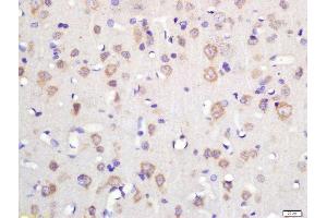 Formalin-fixed and paraffin embedded rat brain labeled with Rabbit Anti-TSPAN12 Polyclonal Antibody, Unconjugated (ABIN2179830) at 1:200 followed by conjugation to the secondary antibody and DAB staining (TSPAN12 antibody  (AA 1-100))