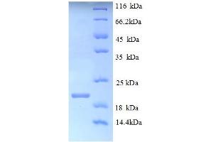SDS-PAGE (SDS) image for Potassium Voltage-Gated Channel, Shaker-Related Subfamily, Member 1 (KCNA1) (AA 1-154), (partial) protein (His tag) (ABIN5709785) (KCNA1 Protein (AA 1-154, partial) (His tag))