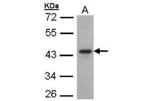 WB Image Sample (30 ug of whole cell lysate) A: HeLaS3 10% SDS PAGE antibody diluted at 1:1000 (FOXE1 antibody  (C-Term))
