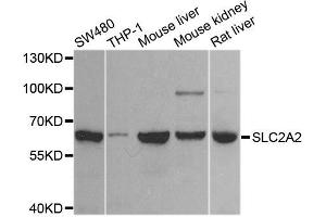 Western blot analysis of extracts of various cell lines, using SLC2A2 antibody (ABIN6003575) at 1/1000 dilution. (SLC2A2 antibody)