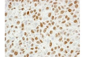 Immunohistochemistry (IHC) image for anti-Proliferating Cell Nuclear Antigen (PCNA) (C-Term) antibody (ABIN7448997) (PCNA antibody  (C-Term))