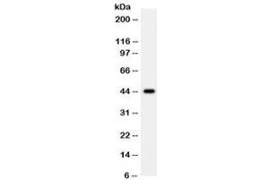 Western blot testing of human 22RV1 cell lysate with WNT2B antibody. (WNT2B antibody)