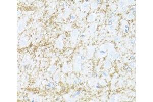 Immunohistochemistry of paraffin-embedded Rat brain using CNP Polyclonal Antibody at dilution of 1:100 (40x lens). (Cnpase antibody)