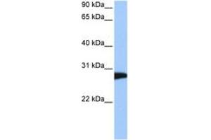 Image no. 1 for anti-N-Ethylmaleimide-Sensitive Factor (NSF) (AA 662-711) antibody (ABIN6744481) (NSF antibody  (AA 662-711))