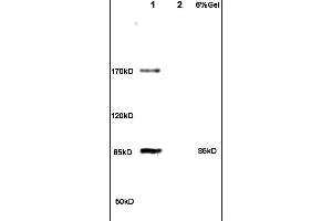 Formalin-fixed and paraffin embedded rat brain tissue labeled with Anti PHLP Polyclonal Antibody,Unconjugated (ABIN715121) at 1:200 followed by conjugation to the secondary antibody and DAB staining. (Phosducin-Like antibody  (AA 51-150))