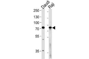 Western Blotting (WB) image for anti-Germ Cell Associated 2 (Haspin) (GSG2) antibody (ABIN3003656)