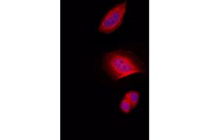 ABIN6257707 and ABIN6274332 staining Hela by IF/ICC. (CHAF1A antibody  (N-Term))
