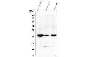 Western blot analysis of TMEM255B using anti-TMEM255B antibody (ABIN7600444). (TMEM255B antibody  (AA 196-240))