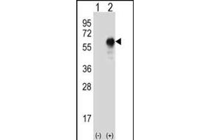 Western blot analysis of LZP (arrow) using rabbit polyclonal LZP Antibody (ABIN655394 and ABIN2844942). (OIT3 antibody)