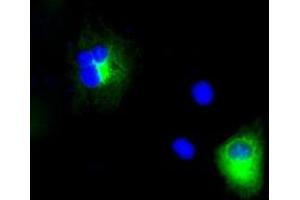 Image no. 3 for anti-Amyloid beta (A4) Precursor Protein (APP) antibody (ABIN1496880) (APP antibody)