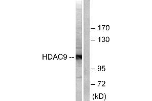 Western blot analysis of extracts from HepG2 cells, using HDAC9 antibody (#C0228).