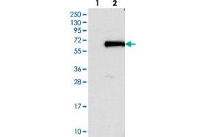 Western blot analysis of Lane 1: Negative control (vector only transfected HEK293T lysate). (FOXN2 antibody)