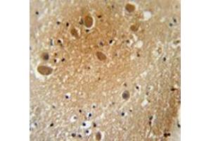 Immunohistochemistry analysis in human brain tissue (Formalin-fixed, Paraffin-embedded) using SPARCL1 / Hevin  Antibody , followed by peroxidase conjugation of the secondary antibody and DAB staining.