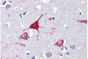 Brain, cortex, Human: Formalin-Fixed, Paraffin-Embedded (FFPE) (USP9X antibody  (AA 2479-2492))