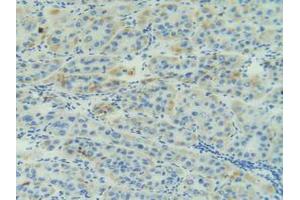 Figure. (Adrenomedullin antibody  (AA 22-147))
