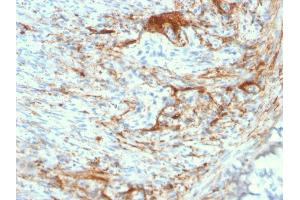 Formalin-fixed, paraffin-embedded human Small Intestine stained with Rabbit Recombinant Monoclonal Antibody (ELN/3131R) to Elastin. (Recombinant Elastin antibody)