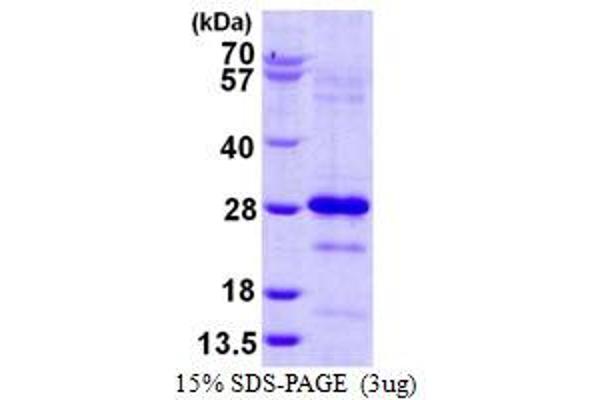 Pallidin Protein (full length) (His tag)