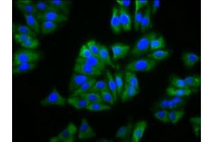 Immunofluorescence staining of HepG2 cells with ABIN7163038 at 1:133, counter-stained with DAPI. (BFSP2 antibody  (AA 11-110))