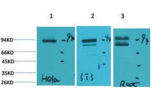 Western Blotting (WB) image for anti-Signal Transducer and Activator of Transcription 1, 91kDa (STAT1) antibody (ABIN3179107) (STAT1 antibody)
