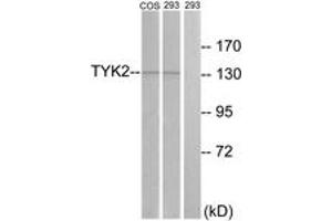 Western blot analysis of extracts from 293/COS7 cells, treated with heat shock, using TYK2 (Ab-1054) Antibody.