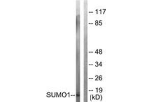 Western blot analysis of extracts from 293 cells, using Sumo1 Antibody. (SUMO1 antibody  (AA 1-50))