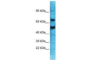 Host: Rabbit  Target Name: Gnl1  Sample Tissue: Mouse Testis lysates  Antibody Dilution: 1. (GNL1 antibody  (C-Term))