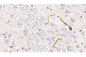Detection of FGg in Mouse Cerebrum Tissue using Polyclonal Antibody to Fibrinogen Gamma (FGg) (FGG antibody  (AA 168-405))