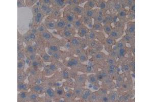 Used in DAB staining on fromalin fixed paraffin- embedded liver tissue (ABCB4 antibody  (AA 1034-1276))