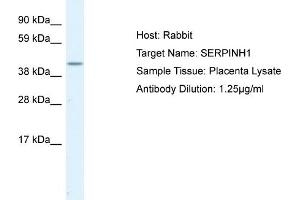 Image no. 1 for anti-Serpin Family H Member 1 (SERPINH1) (C-Term) antibody (ABIN184193) (SERPINH1 antibody  (C-Term))