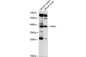 Western blot analysis of extracts of various cell lines, using NME7 antibody (ABIN7269055) at 1:1000 dilution. (NME7 antibody  (AA 1-376))