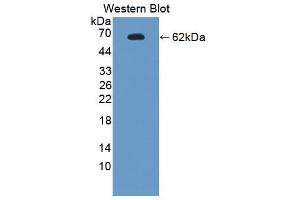 Western blot analysis of the recombinant protein. (Endonuclease G antibody  (AA 1-294))