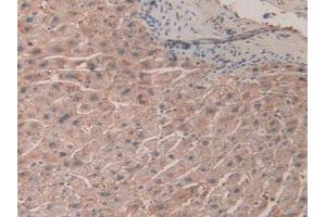 IHC-P analysis of Human Liver Tissue, with DAB staining. (SHC3 antibody  (AA 188-433))