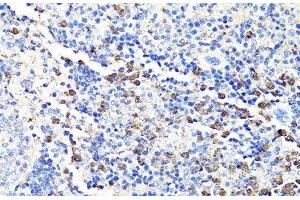 Immunohistochemistry of paraffin-embedded Mouse spleen using S100A9 Polyclonal Antibody at dilution of 1:100 (40x lens). (S100A9 antibody)