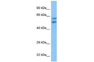 Host:  Rabbit  Target Name:  TTC6  Sample Tissue:  Liver Tumor lysates  Antibody Dilution:  1ug/ml (TTC6 antibody  (N-Term))