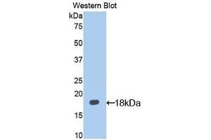 Detection of Recombinant IL13Ra1, Mouse using Polyclonal Antibody to Interleukin 13 Receptor Alpha 1 (IL13Ra1) (IL13 Receptor alpha 1 antibody  (AA 28-171))