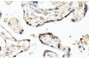Immunohistochemistry of paraffin-embedded Human placenta using KLF5 Polyclonal Antibody at dilution of 1:100 (40x lens). (KLF5 antibody)