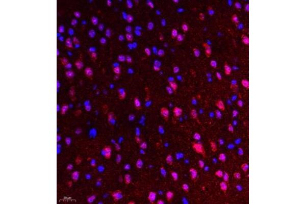 WHSC1L1 antibody