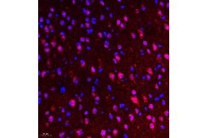 Immunofluorescence of paraffin embedded mouse brain using NSD3 (ABIN7076233) at dilution of 1:650 (400x lens) (WHSC1L1 antibody)