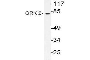 Western blot (WB) analysis of GRK 2 antibody in extracts from Jurkat cells. (GRK2 antibody)